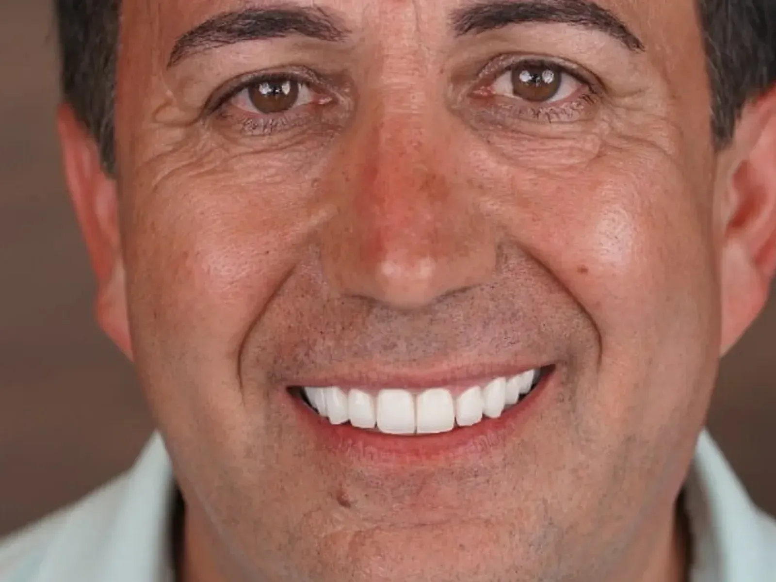 After dental implants — case from our clinic
