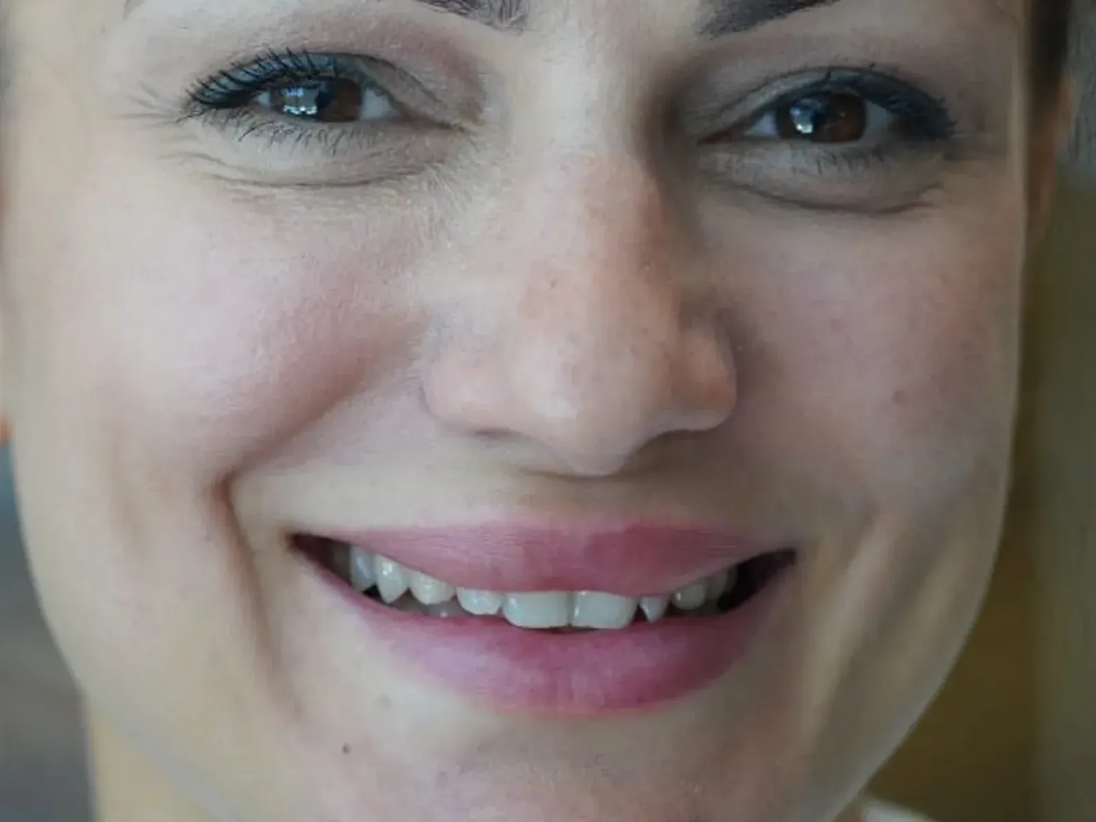 Before dental implants — case from our clinic