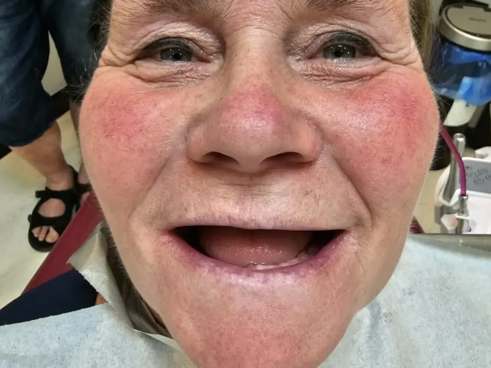 Before dental implants — case from our clinic