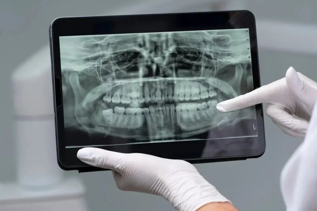 Dental team reviewing digital implant planning on screen